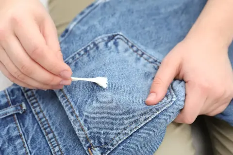 Mani che rimuovono la cingomma dai jeans con un cotton fioc. Ecco come togliere la cingomma dai vestiti.