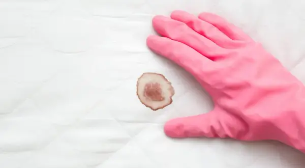 Mano con guanto rosa pronto a pulire macchie di sangue su tessuto bianco trapuntato.